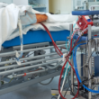 Specialized medical equipment connected to a patient during a vascular treatment procedure in a hospital setting.