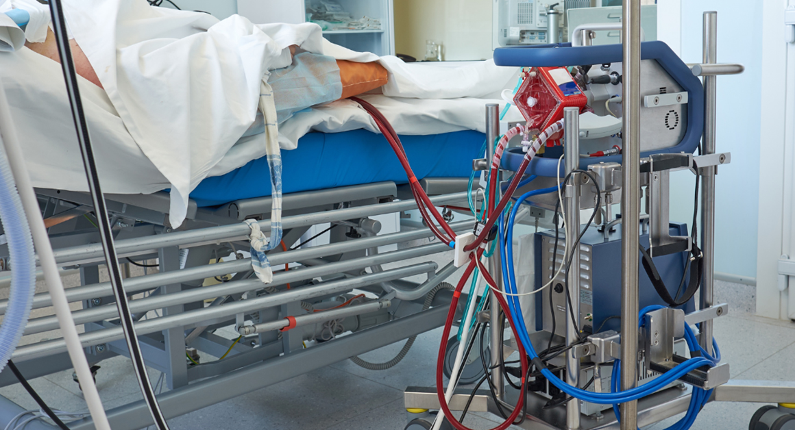 Specialized medical equipment connected to a patient during a vascular treatment procedure in a hospital setting.