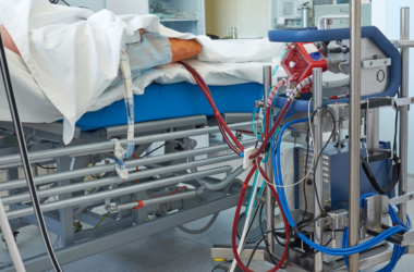 Specialized medical equipment connected to a patient during a vascular treatment procedure in a hospital setting.