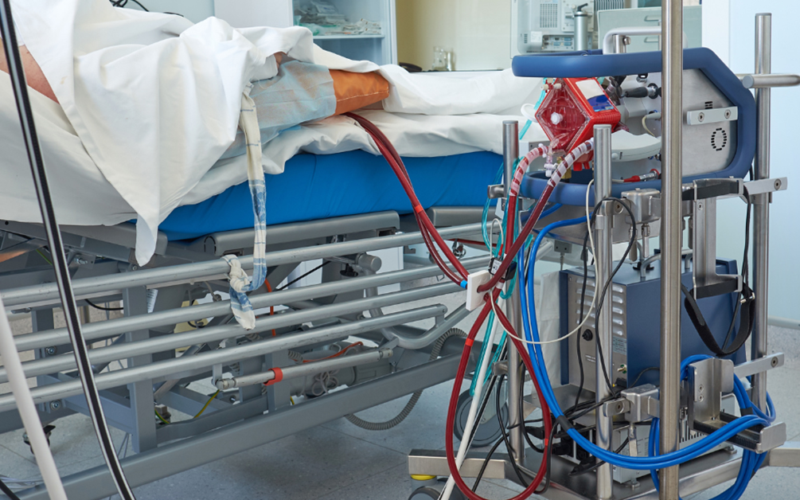 Specialized medical equipment connected to a patient during a vascular treatment procedure in a hospital setting.