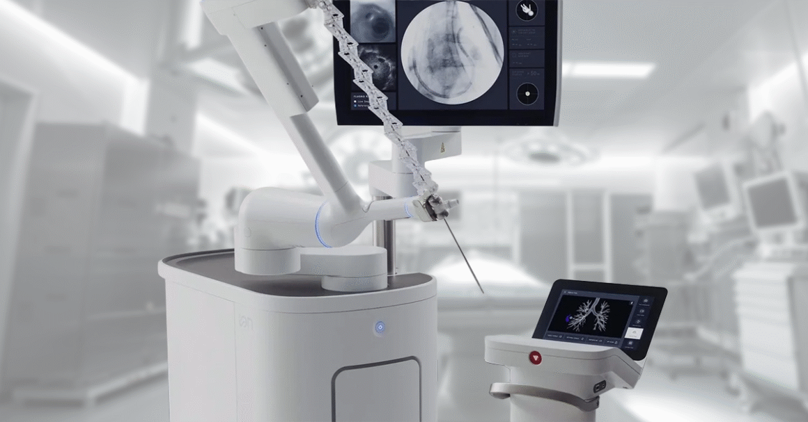 Early Detection Saves Lives: Ion Robot Bronchoscopy at UMC - UMC Cares