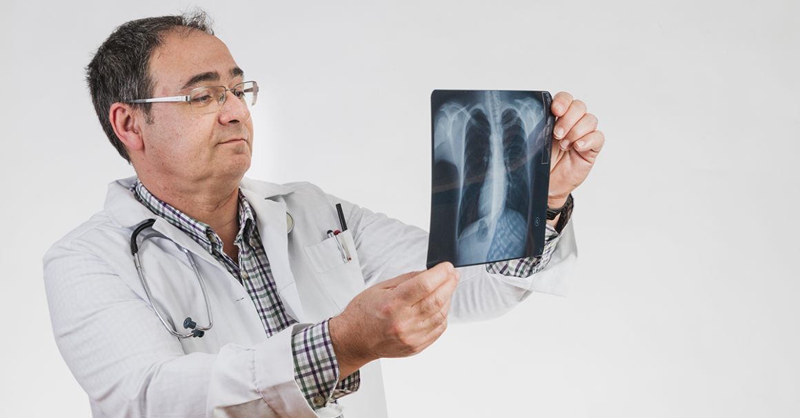 A doctor looking closely at some x-rays, referencing lung health.
