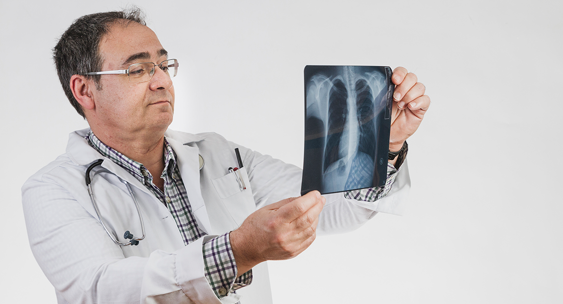 A doctor looking closely at some x-rays, referencing lung health.