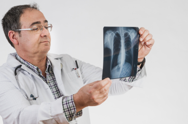 A doctor looking closely at some x-rays, referencing lung health.