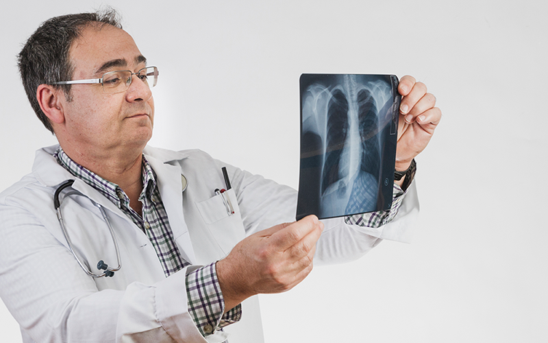 A doctor looking closely at some x-rays, referencing lung health.
