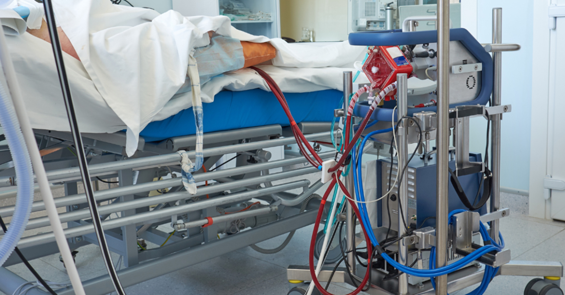 Specialized medical equipment connected to a patient during a vascular treatment procedure in a hospital setting.